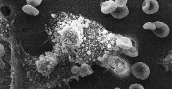 Picture 2 of Hornet bee venom can kill cancer cells