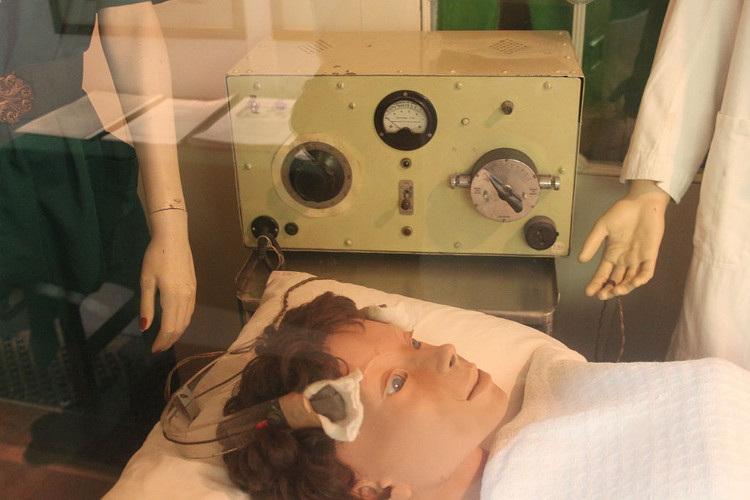 'Horrific' medical treatments in history images 4