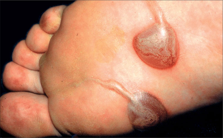 Picture 8 of Horror diseases are not for the weak