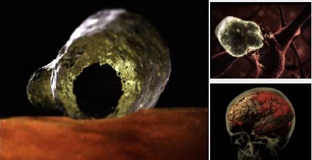 Picture 4 of Horror parasites on the human body