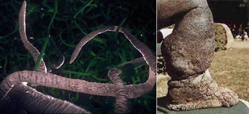 Picture 5 of Horror parasites on the human body