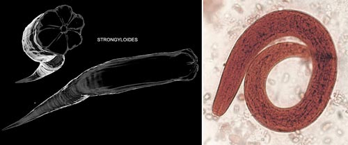 Picture 6 of Horror parasites on the human body