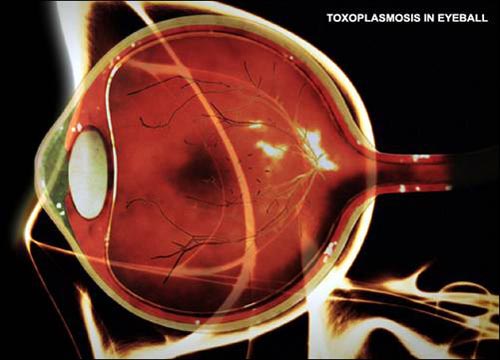 Picture 7 of Horror parasites on the human body