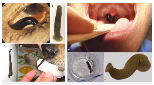 Picture 2 of Horror story is true: what will happen if the parasite leeches in the throat?