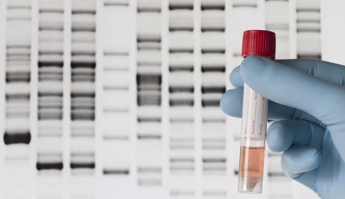 Picture 1 of How accurate is the DNA test for the biological child?