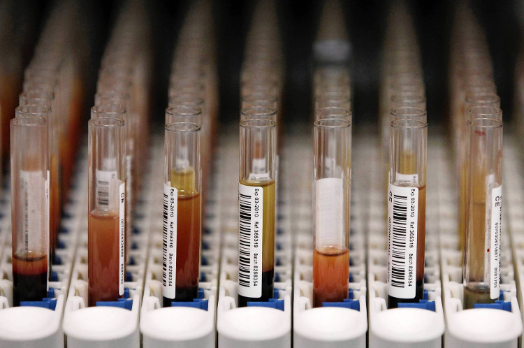 Picture 7 of How can technology and medicine help people prolong life?