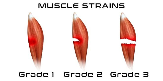 How Dangerous Thigh Muscle Injury