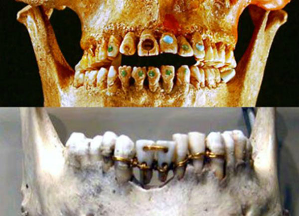Picture 2 of How did the ancient people grow their nostrils?