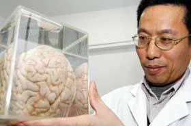 Picture 1 of How do Chinese people use the brain?