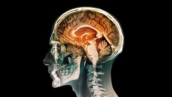 Picture 3 of How does man work if only half of his brain is left?