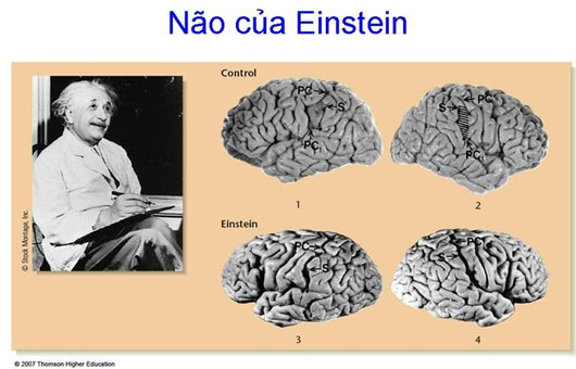 Picture 5 of How does the brains of geniuses work?  (first)