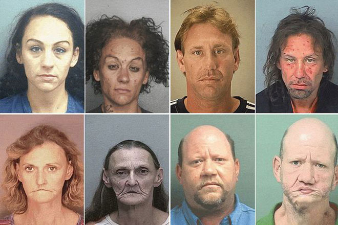 Picture 10 of How drugs destroy the human face