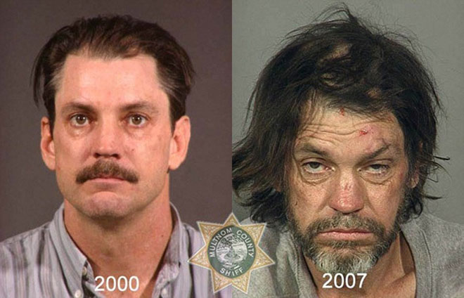 Picture 3 of How drugs destroy the human face