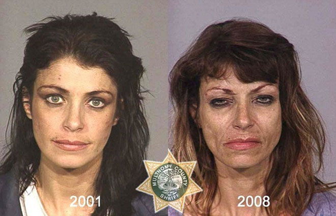 Picture 4 of How drugs destroy the human face