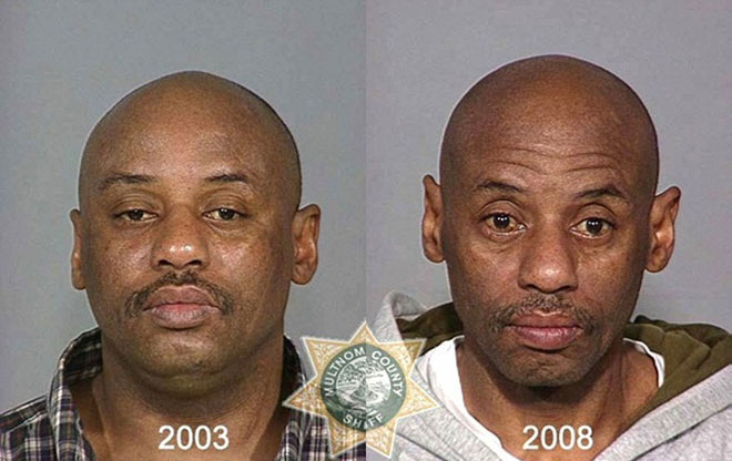 Picture 8 of How drugs destroy the human face