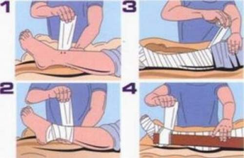 Picture 5 of How is bitten by poisonous snake, first aid?