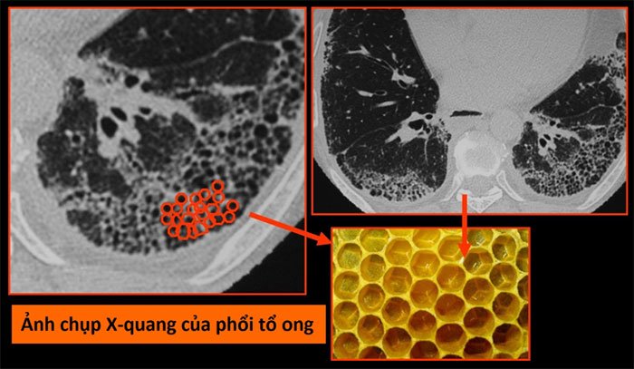 Picture 2 of How new corona virus wreaks havoc on body parts?