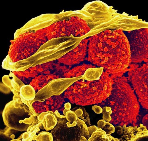 Picture 6 of How organisms evolved in modern times