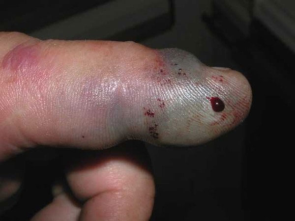 Picture 6 of How to be attacked by a red-tailed snake?
