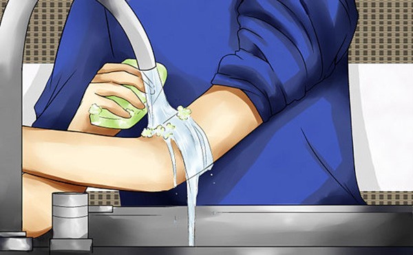 Picture 5 of How to deal with bee stings