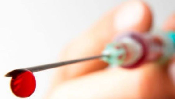 Picture 1 of How to deal with being stabbed by sharp objects suspicious of HIV blood
