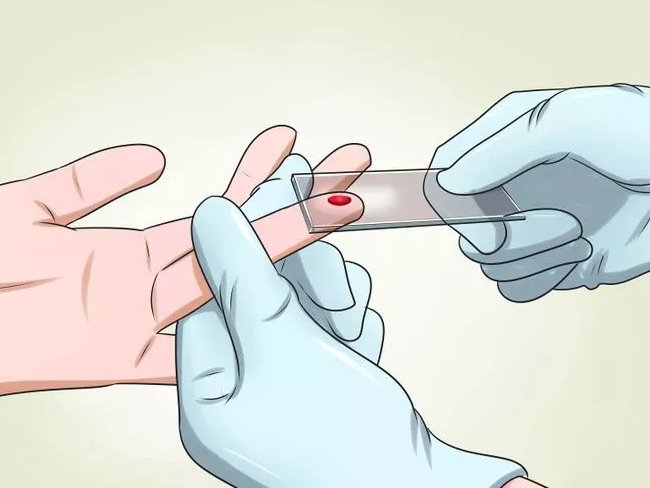Picture 7 of How to diagnose, treat and prevent malaria
