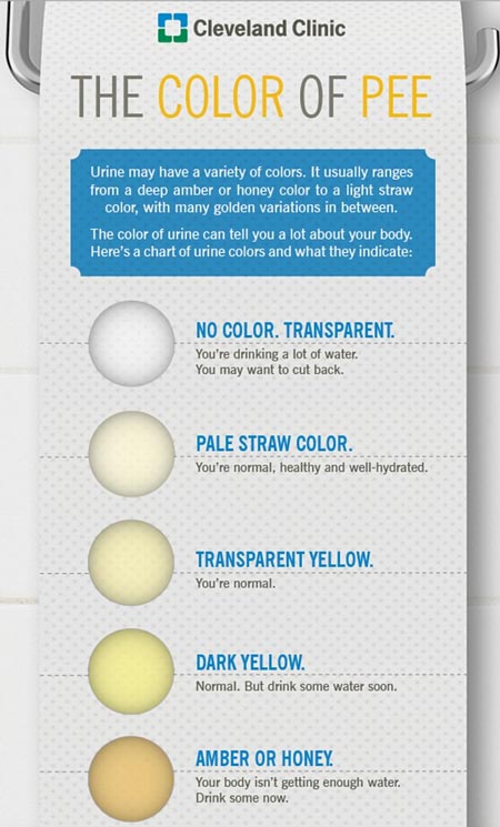 Picture 2 of How to guess disease from urine color