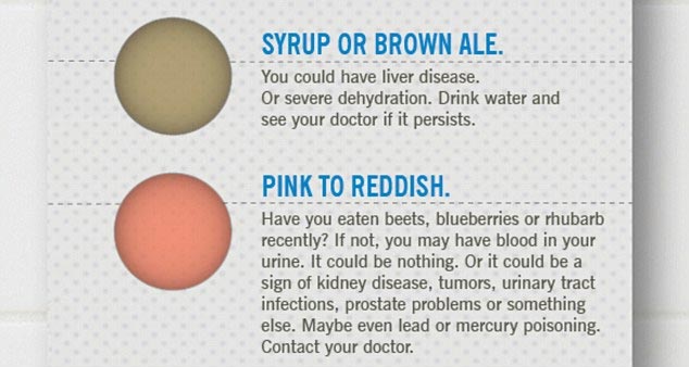Picture 3 of How to guess disease from urine color
