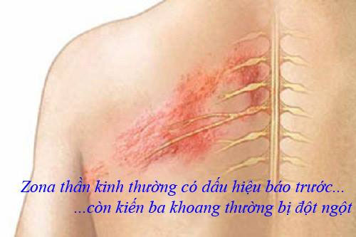 Picture 3 of How to handle wounds caused by three-chamber ants is simple without going to the hospital