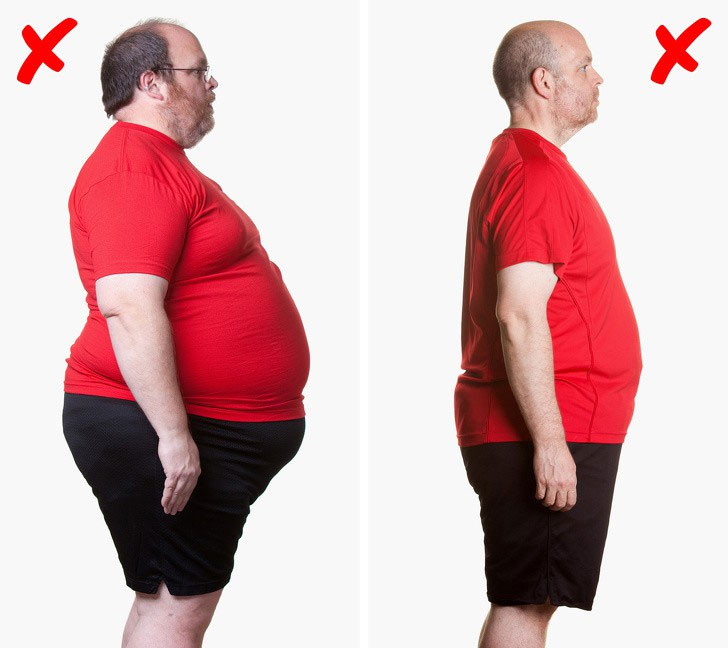 Picture 2 of How to limit the terrible pain caused by gout
