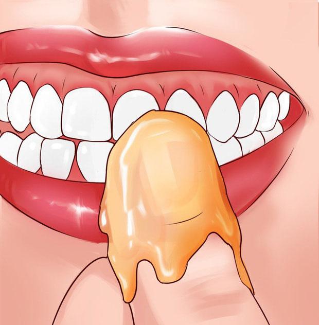 Picture 7 of How to overcome bleeding gums