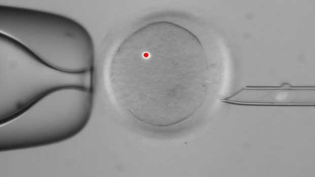 Picture 1 of Human embryo production from genes of 3 people