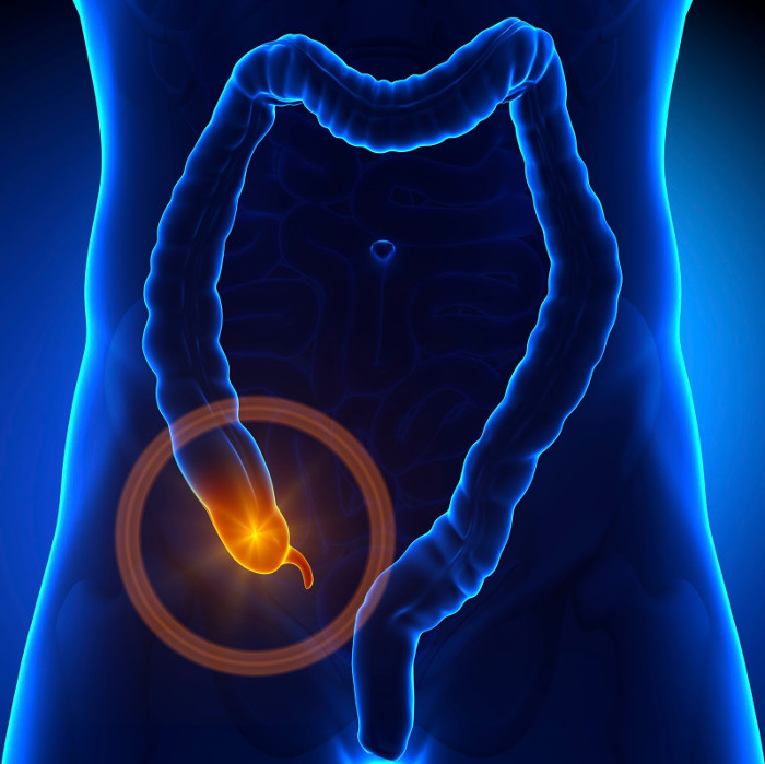 Picture 1 of Ideas are useless, but the appendix seems to play a very important role