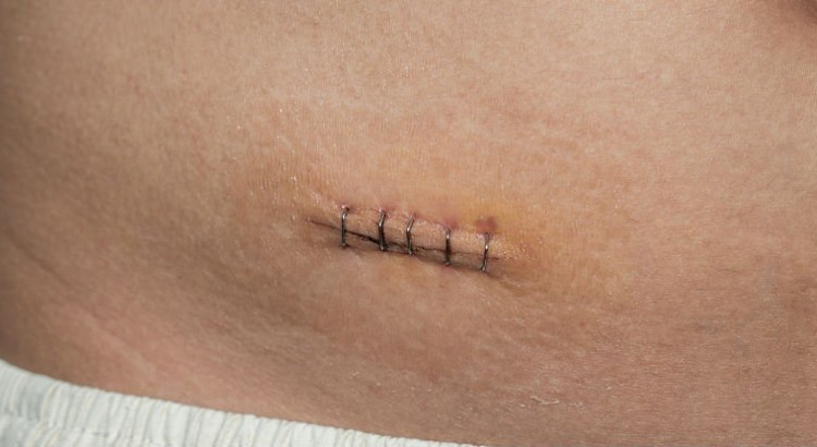 Picture 2 of Ideas are useless, but the appendix seems to play a very important role