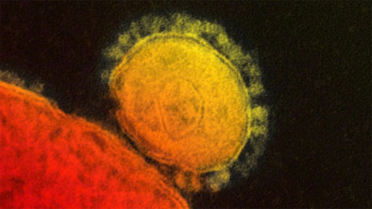 Picture 1 of Identify two antibodies that promise to fight MERS