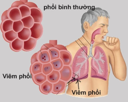 Impact of honeycomb charcoal on health