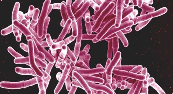 Picture 1 of Implants can kill up to 98% of bacteria