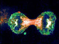 Picture 1 of In 2030, the world has 75 million people living with cancer
