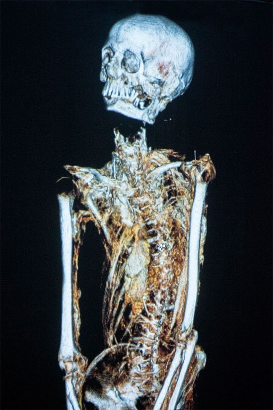 Picture 6 of In the 2500-year-old mummy is a ... broomstick