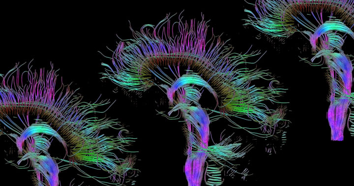 Picture 2 of In the future, the fate of coma patients will be decided by computer algorithms