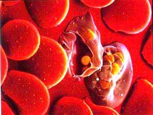 Picture 1 of In the next 5 years, the malaria vaccine is available in the market