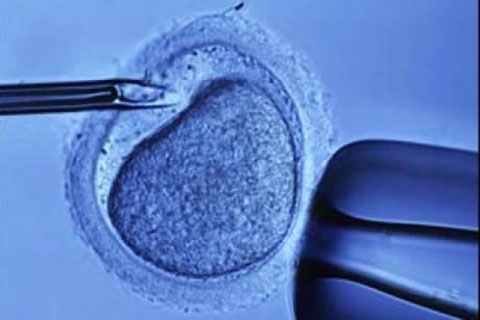 Picture 1 of 'In vitro fertilization' has a moral violation?