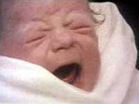 Picture 1 of In vitro fertilization: Mature, normal childbirth