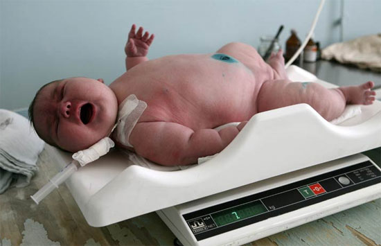 Picture 1 of Infant weight is related to autism