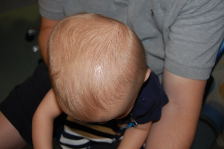Picture 1 of Infant's head: what mom should know!