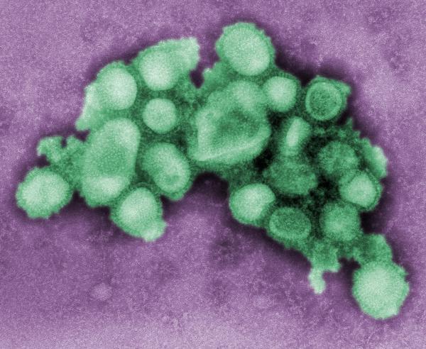 Picture 1 of Influenza A / H1N1 and its relationship with arsenic exposure at common levels