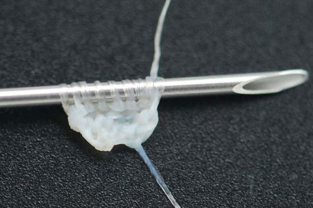 Picture 1 of Initiative to use human skin sutures for suturing patients