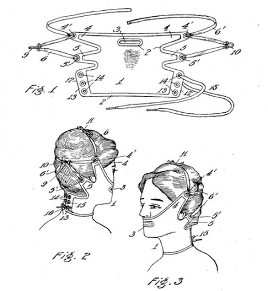 Picture 4 of 'Insane' beauty tools in the early 20th century