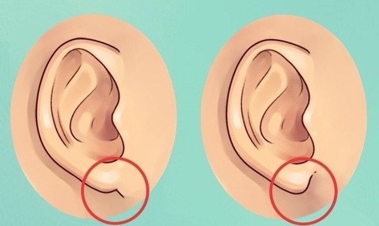 Picture 2 of Interesting facts about ears most people don't know