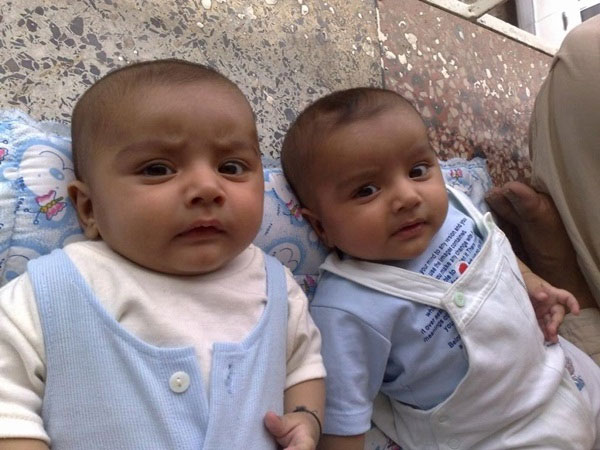 Picture 2 of Interesting things about twins that you may not know yet